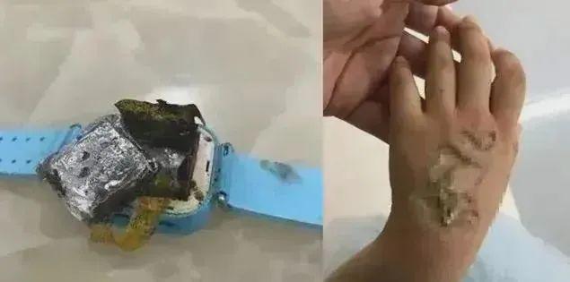 突发自燃！快检查你家宝贝的电话手表！(图2)